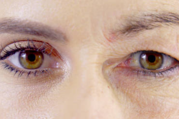 Main Cause of Wrinkles & Saggy Skin: Aging, Sun Exposure, & Loss of Collagen