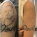 remove tattoo